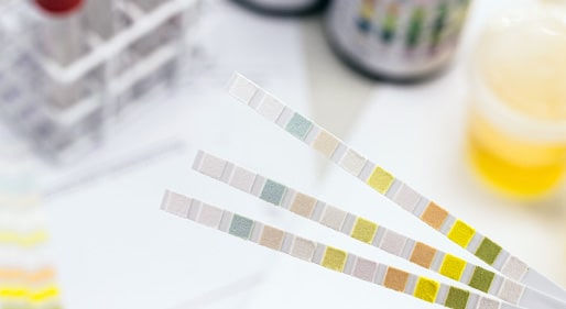 Test Strips Example Test Strips & Diagnostics – MediSale